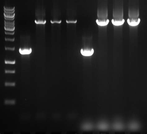 Agarose gel electrophoresis of DNA | Cleaver Scientific