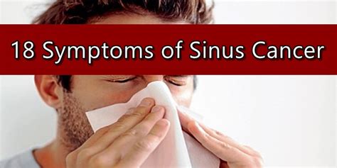 SINUS CANCER SYMPTOMS - 18 Signs Of Nasal Cavity Cancers