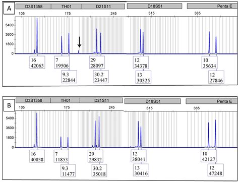 CIMB | Free Full-Text | Usage of DNA Fingerprinting Technology to Check ...