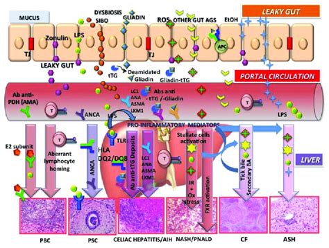 Gut-liver axis and liver diseases. Increased intestinal permeability ...