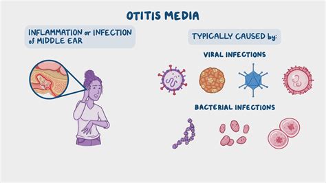 Otitis media: Nursing - Osmosis Video Library