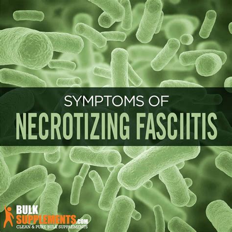 Necrotizing Fasciitis: Symptoms, Causes & Treatment by James Denlinger
