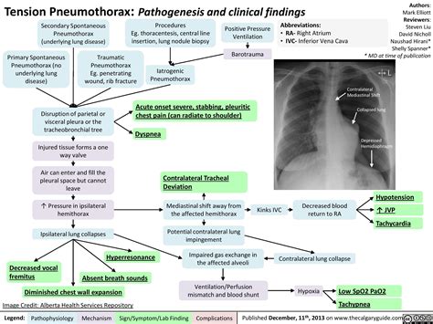 Pneumothorax Causes