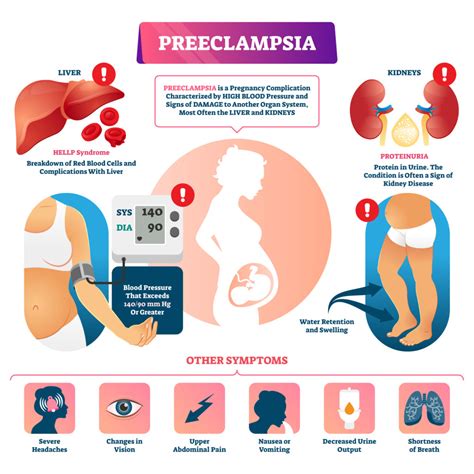 POSTPARTUM PREECLAMPSIA - Living Tower Medical Services