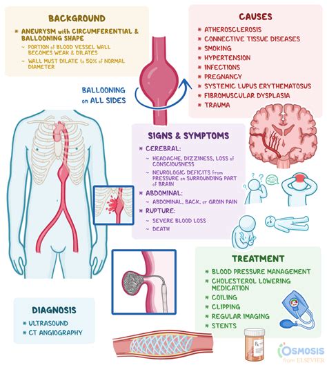 What Is An Aneurysm Causes Symptoms Treatments And Prevention The Sun ...