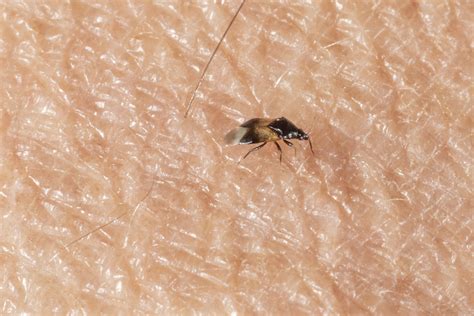 Tiny Flying Bugs In My House That Bite | Psoriasisguru.com