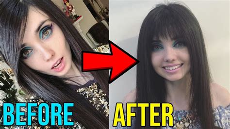 Eugenia Cooney's Journey To Recovery: The Truth Behind Her Health