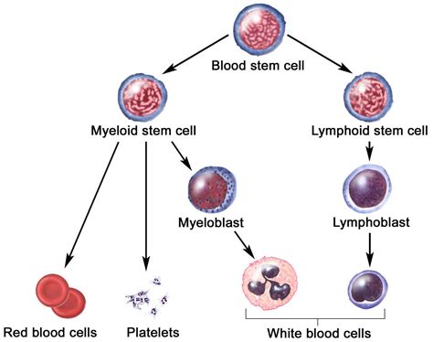 Myelogenous leukemia, acute, chronic, symptoms, diagnosis & treatment