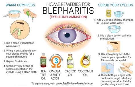 Seborrheic Blepharitis Treatment