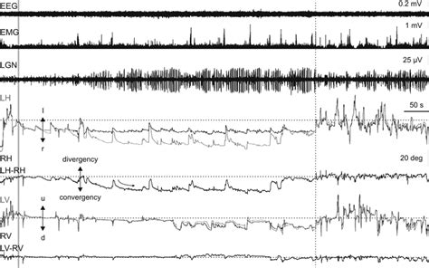 Unilateral microinjections of carbachol in the NRPC induce tonic and... | Download Scientific ...