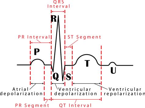 How to Do an ECG at Home | Wellue 24 Hour ECG Recorder | Interactive ...