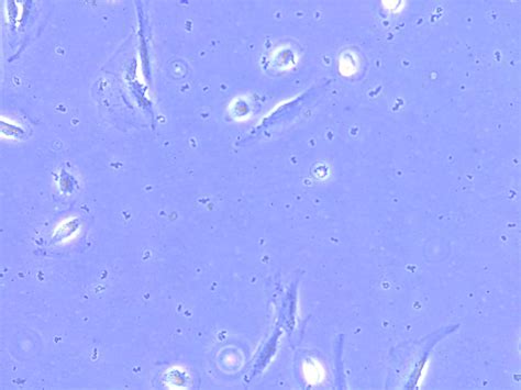 How to identify the cell debris with contamination in the cell culture?