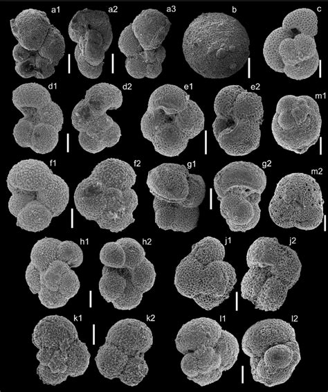 Foraminifera. Selection of planktonic and benthic foraminifera from... | Download Scientific Diagram