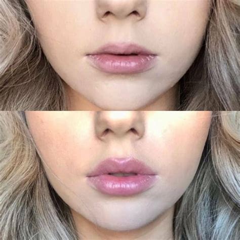 best homemade lip plumer in 2020 | Lip plumper, Lip plumpers that work, Homemade lip plumper