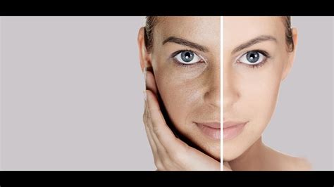 Skin Tightening Home Treatment - YouTube