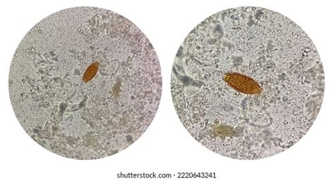 13 Trichuris Trichiura Ova Images, Stock Photos & Vectors | Shutterstock