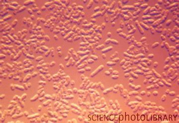 Ochrobactrum anthropi - microbewiki