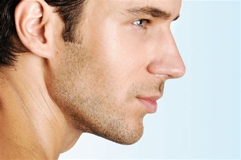 Kybella for Men | Reduce a Double Chin & Refine Your Jawline | Kalos ...