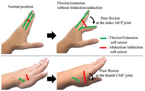 Metacarpophalangeal Joint Extension