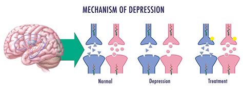 Happy or SAD: The chemistry behind depression