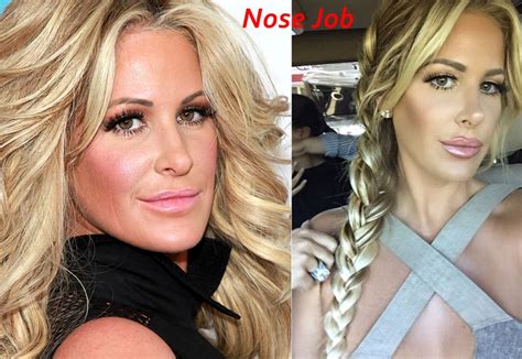 Kim Zolciak Plastic Surgery Before And After Instagram Photos | 2018 ...