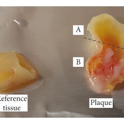 Representative tissue fragments. The fragment A above the dotted line ...