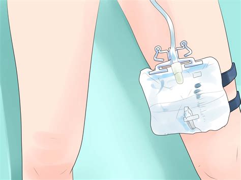 How to Use a Urinary Catheter for a Female: 14 Steps