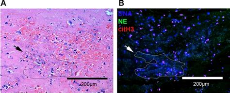 Identification of Neutrophil Extracellular Traps in Paraffin-Embedded Feline Arterial Thrombi ...