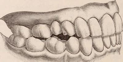 Omnivore Teeth Structure