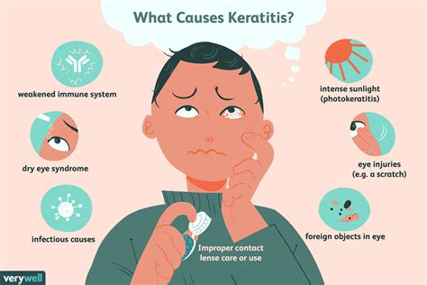 Keratitis: Symptoms, Causes, Diagnosis, and Treatment