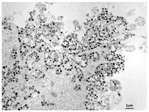 Vaccines | Special Issue : Treatment of Orthopoxvirus Infections