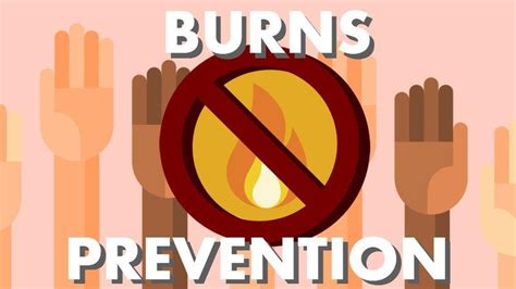 Burn Prevention Tips and Resources - Ridge Volunteer Fire Department