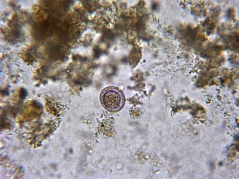 Fun With Microbiology (What's Buggin' You?): Hymenolepis nana