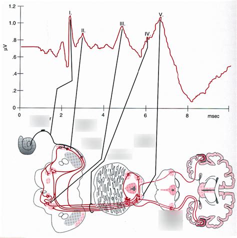 15-18 Auditory Brainstem Response (ABR) anatomical correspondence ...