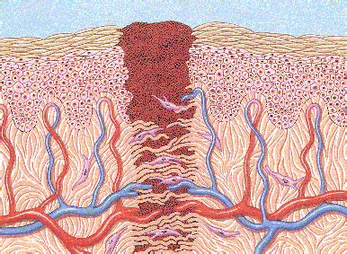 Jonathan Sherratt's Research: Scar Formation