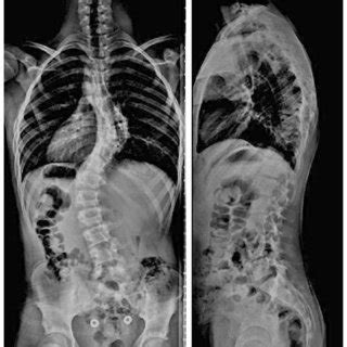 Proposed treatment algorithm for patients with rib dislocation and... | Download Scientific Diagram