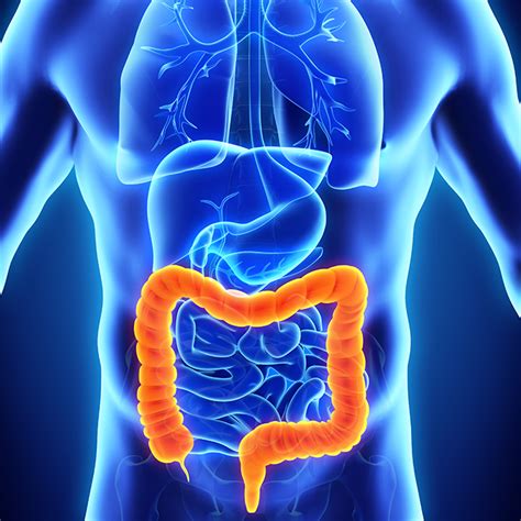 Sigmoid Colon Resection Diet