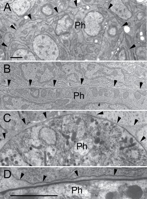 Basal lamina and pseudocoelom development. (A) Embryo during... | Download Scientific Diagram