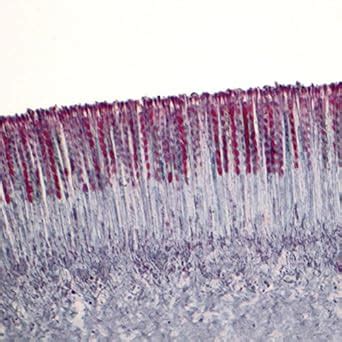 Amazon.com: Cup Fungus Apothecium, sec., 12 m Microscope Slide: Industrial & Scientific