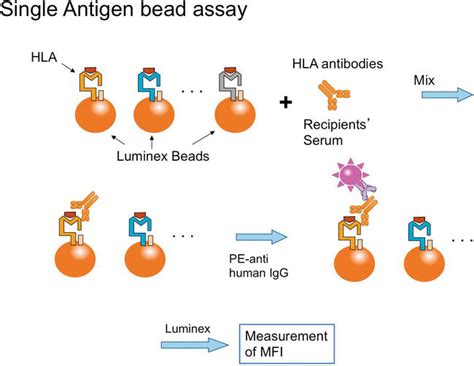 Donor-Specific Anti-HLA Antibodies in Organ Transplantation: Transition ...