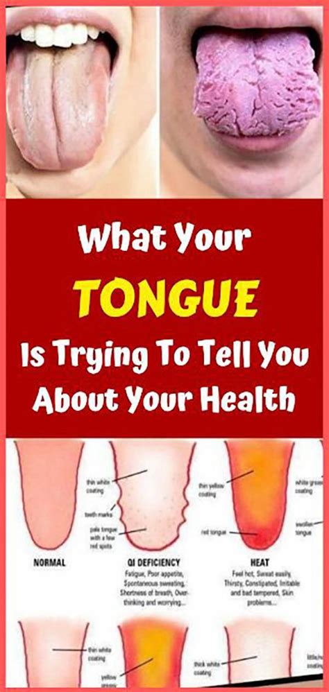 Pin by Rita Legan on Home remedies | Tongue health, Natural health tips ...