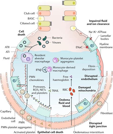 Frontiers | Gene Therapy for Acute Respiratory Distress Syndrome