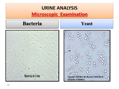 bacteria in urine microscopic examination