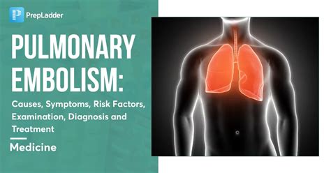 Pulmonary Embolism: Causes, Symptoms, Risk Factors, Examination ...