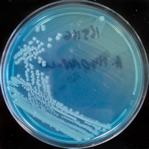 Aeromonas hydrophila on C.L.E.D. agar | Aeromonas hydrophila… | Flickr