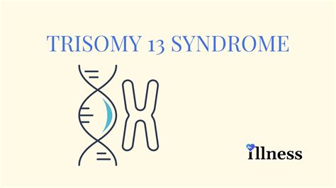 Trisomy 13 Syndrome : Overview, Causes, Symptoms, Treatment - illness.com