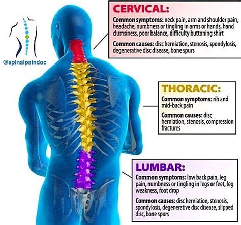 Pin on Washington DC Osteoarthritis Care