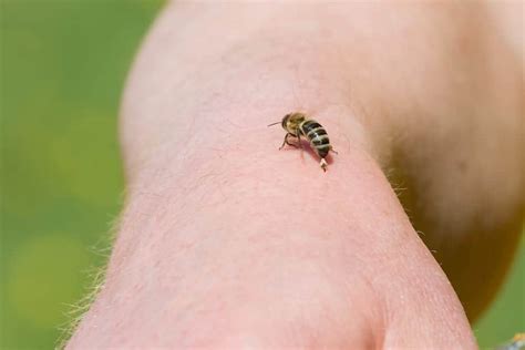 How Long Does A Bee Sting Hurt A Dog