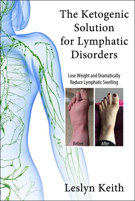 Diet Lymphedema