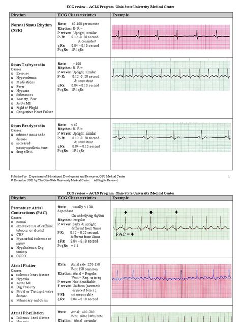 EKG Examples | Electrocardiography | Cardiovascular Physiology